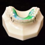 hawley orthodontic retainer